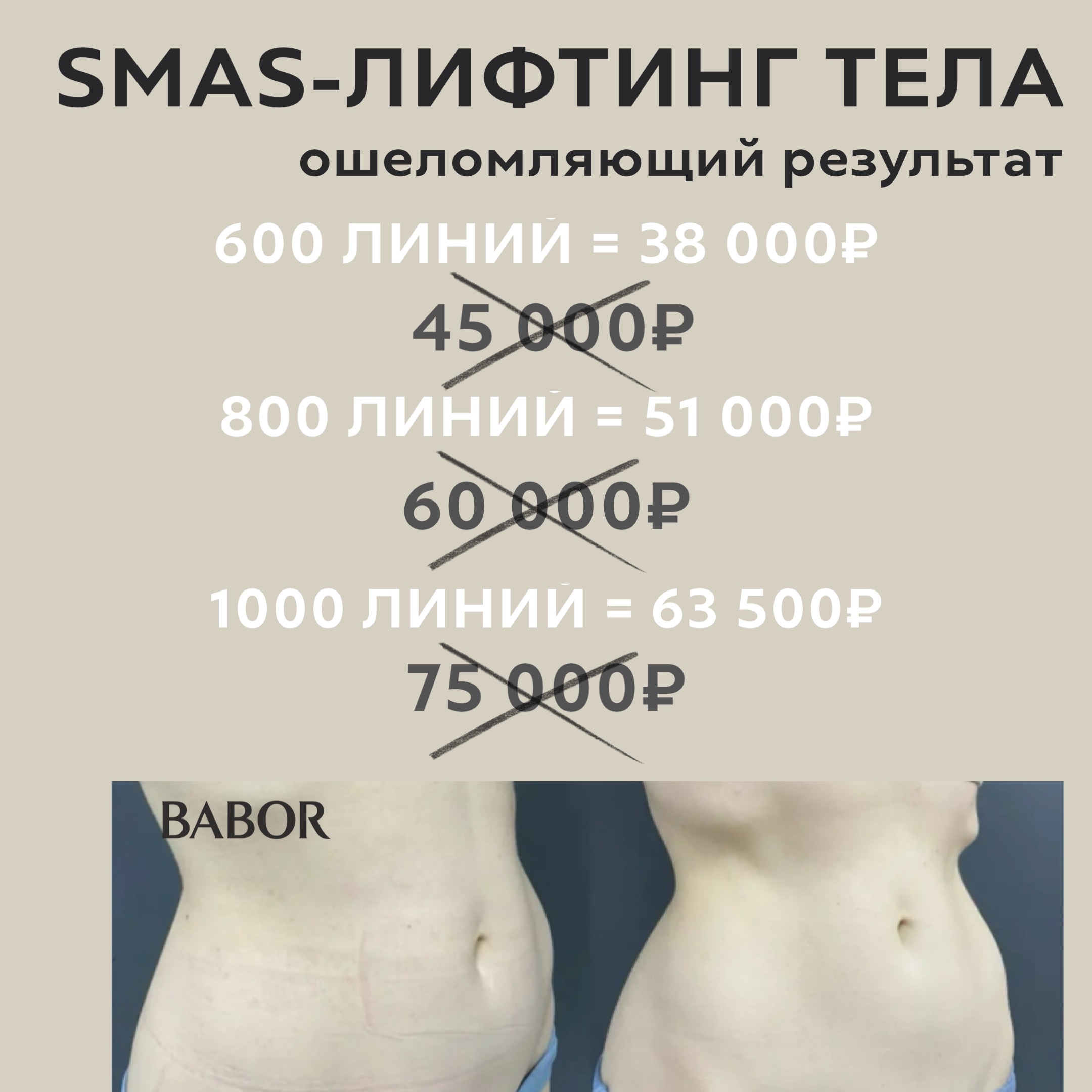 BABOR — СПЕЦИАЛЬНОЕ ПРЕДЛОЖЕНИЕ