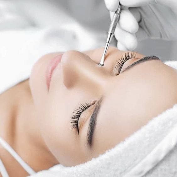 Дерматологическая чистка при акне