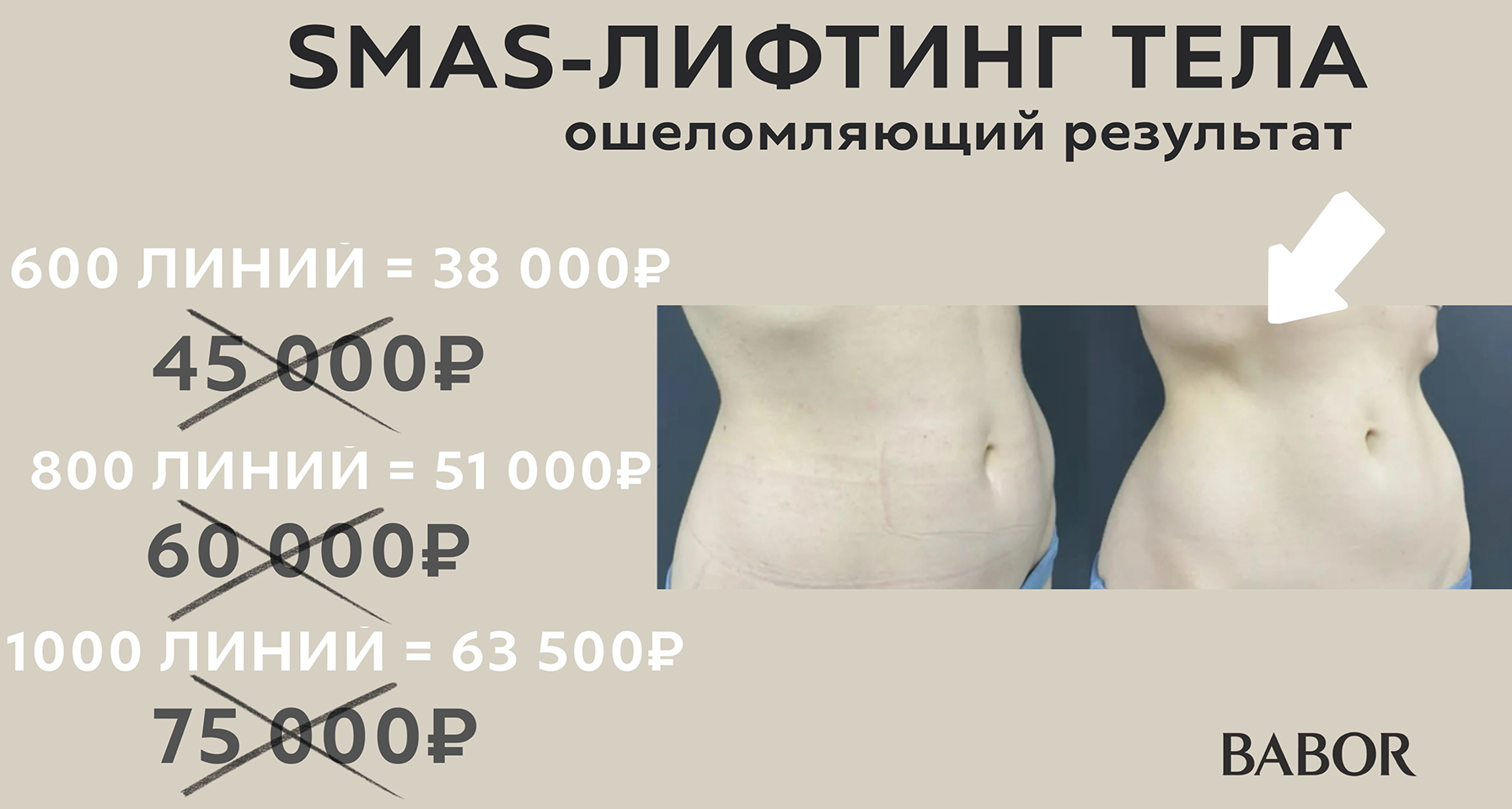 BABOR — СПЕЦИАЛЬНОЕ ПРЕДЛОЖЕНИЕ
